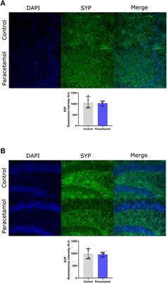 Paracetamol (Acetaminophen) and its Effect on the Developing Mouse Brain